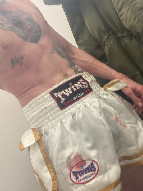 MR WINTER model perfect galleries