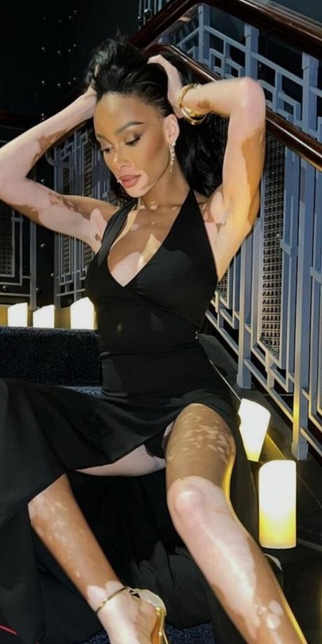 Winnie Harlow exclusive pornstar images