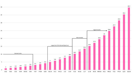 Mal Malloy modèle nu images