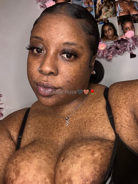 Freckledfantasy5 modèle sexy image