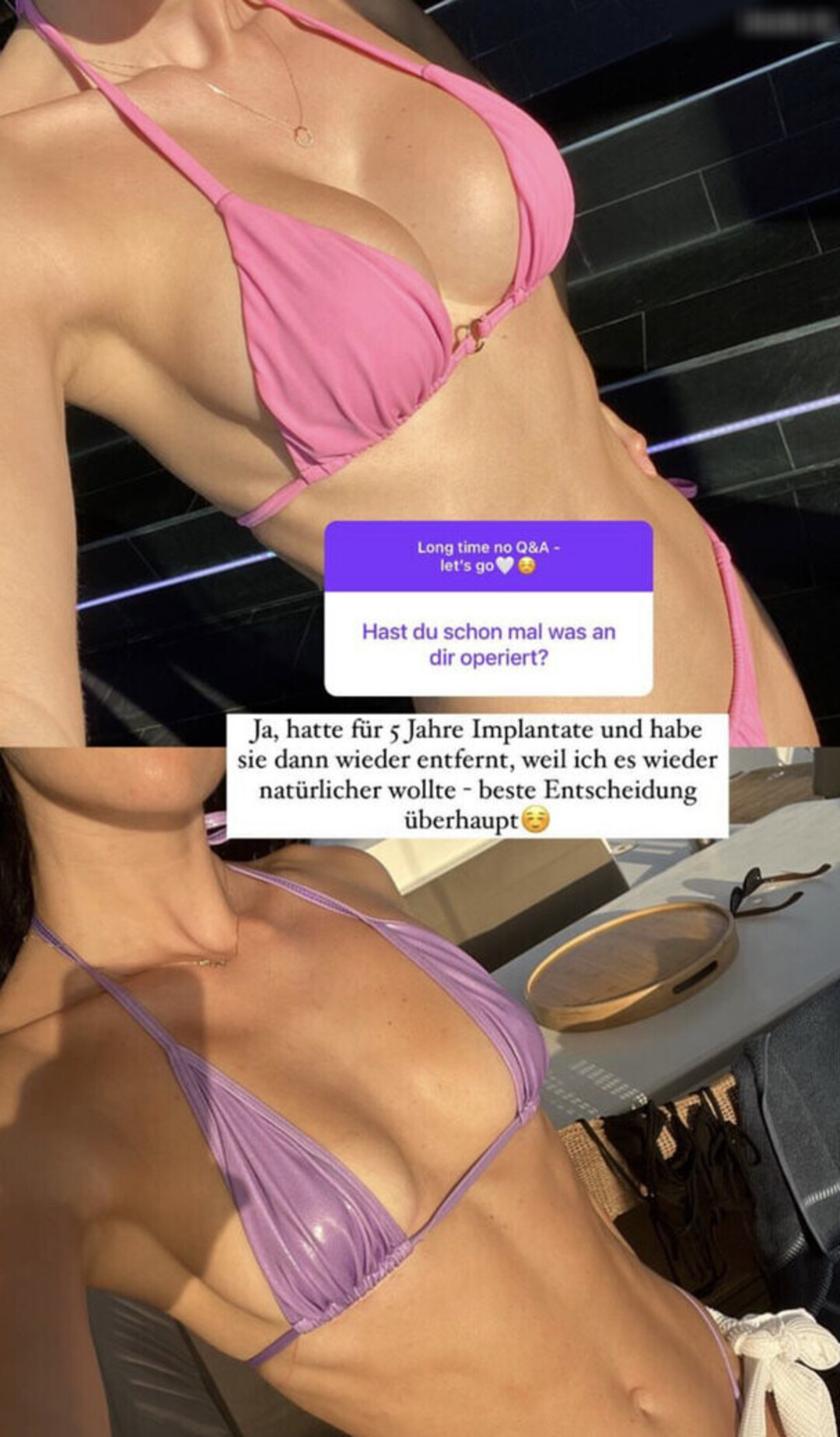 cameltoe uniquementfans exclusivité de haute qualité des photos