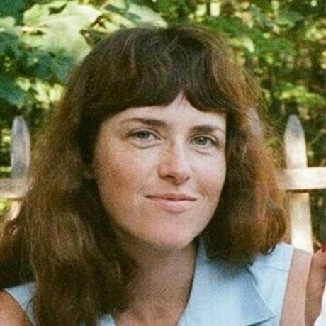 transexuelle post-opératoire onlyfans sexy xxx image