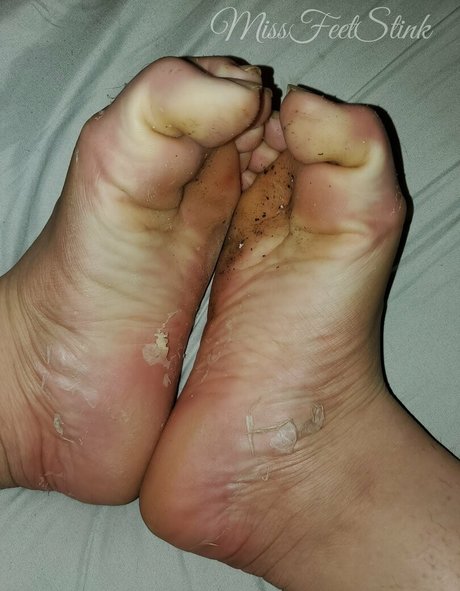 missfeetstinkvip modèles nus archive