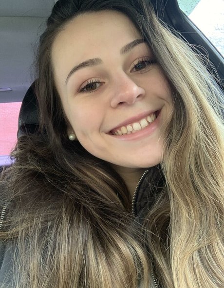 transexuelle post-opératoire onlyfans chaud belle galerie