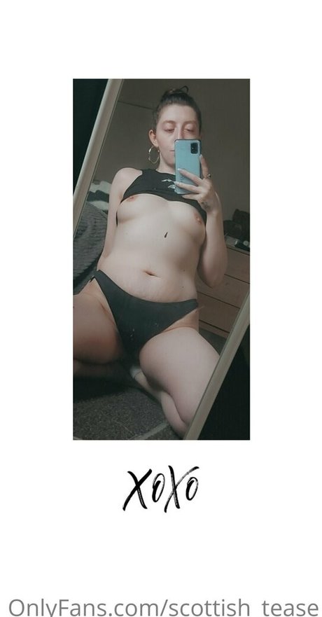 scottish tease modèles nus archive