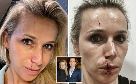 Lara Lewington actrice hd photos