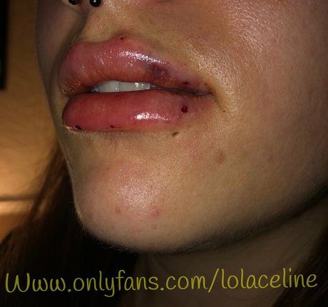 lolaceline haut étoile image