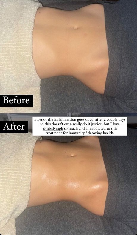 fans fétichistes de la graisse uniquement nu meilleur archive