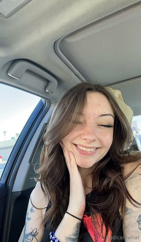 radical4what modèle chaud galerie