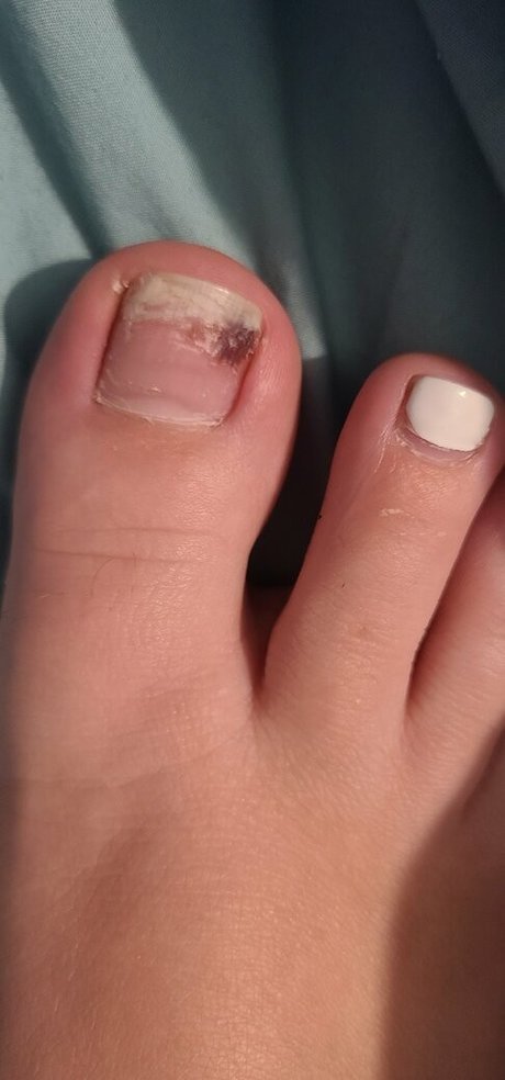 smelliefeetsweetie étoile parfaite collection