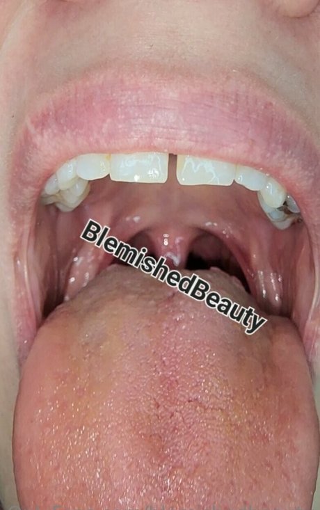 blemishedbeauty meilleur modèle photo