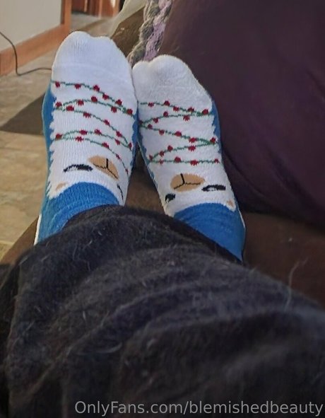 blemishedbeauty star exclusive galeries