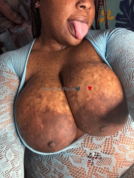 Freckledfantasy5 モデル 写真