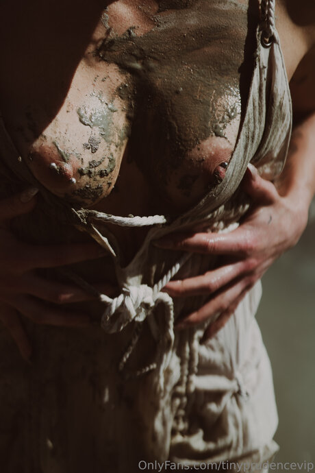 術後シーメールOnlyFans ポルノグラフィック 写真