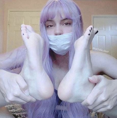achilles heelz トップスター 写真