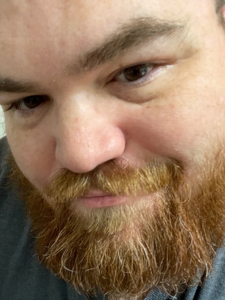 The Red Bearded Dom ヌードスター 写真