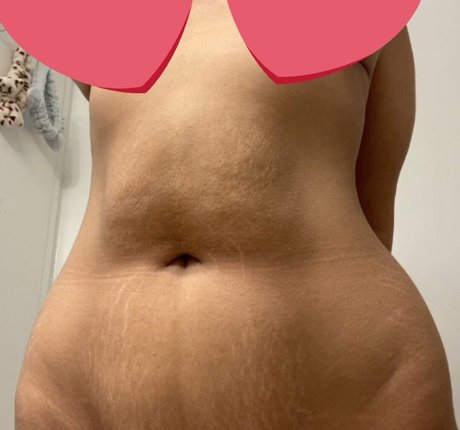 Fwoingus HDモデル 画像