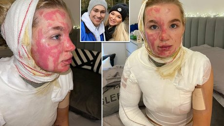 Abbie Quinnen アダルトモデル 写真