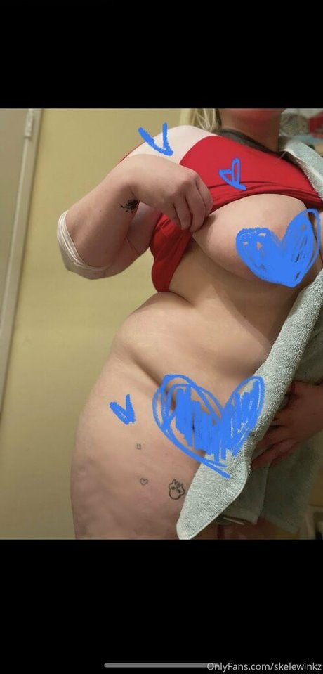 skelewinkz アダルトスター 写真