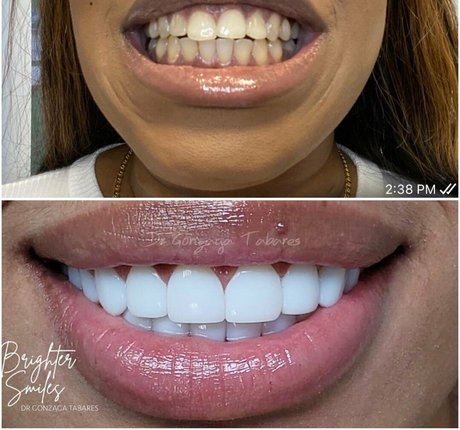 lesbiennes noires onlyfans érotique parfait photos