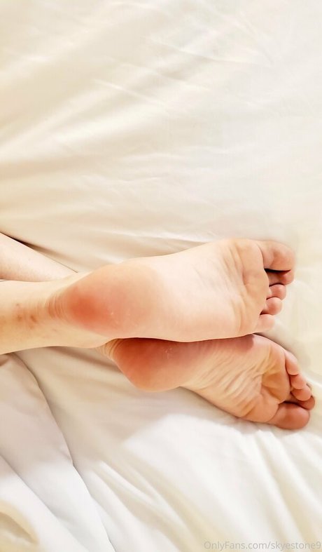 skyestone9 modèle adulte galeries