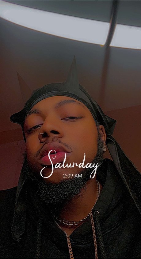 DOSE OF CL_ étoile magnifique galerie