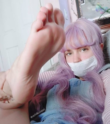 achilles heelz modèle sympa image