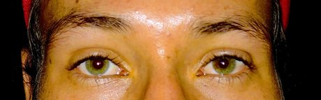 Alan Meyer_ étoile parfaite galerie