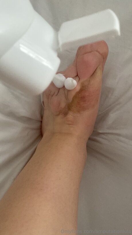 Amputationlula actrice hd images