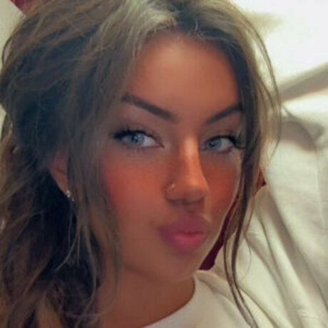 Honeyxxo étoile galerie