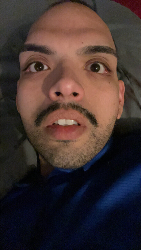 LG730 étoile xxx images