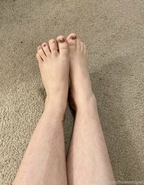 ilovewedgies xxx étoile galerie