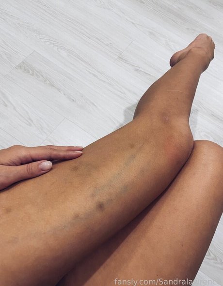 sandralawrence meilleure actrice galeries