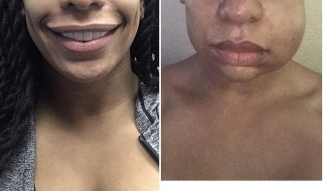 ventilateurs corporels uniquement chaud nu img