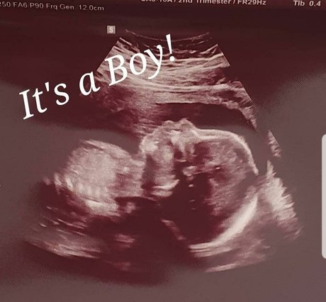 chatte giclante onlyfans parfaite haute qualité img