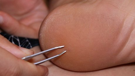 eurasian feet actrice exclusive galerie