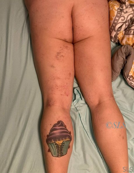 rckyshow meilleure étoile galerie