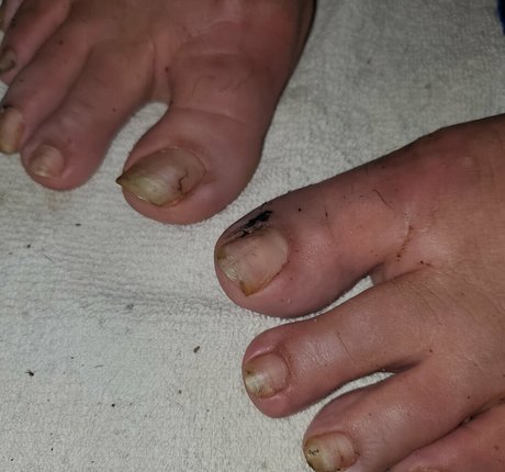 missfeetstink étoile nue image