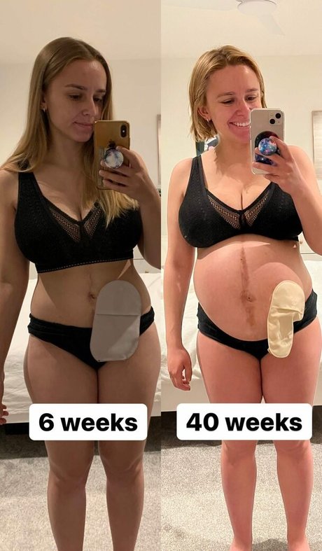 Hannah Witton belle étoile image