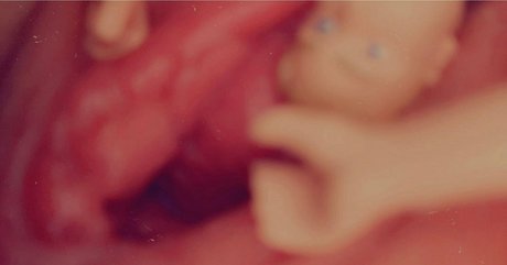 femboy xxx uniquementfans xxx gratuit collection