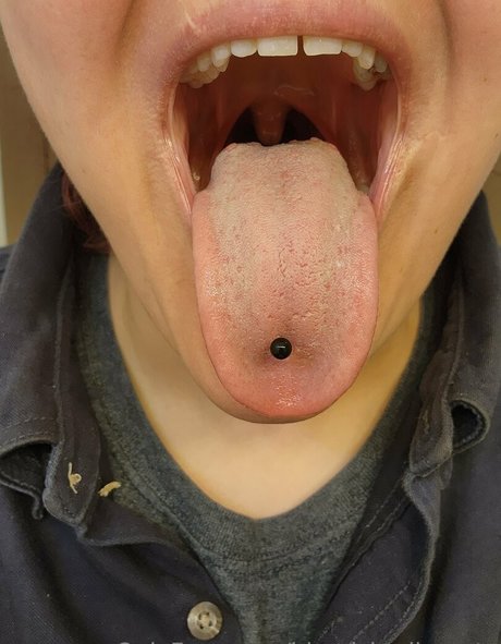 blemishedbeauty star du porno érotique galeries