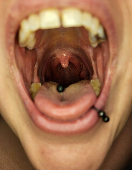 filles emo onlyfans haut xxx image